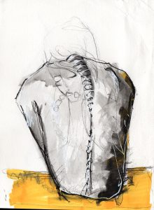 Painting of a back with scoliosis. 